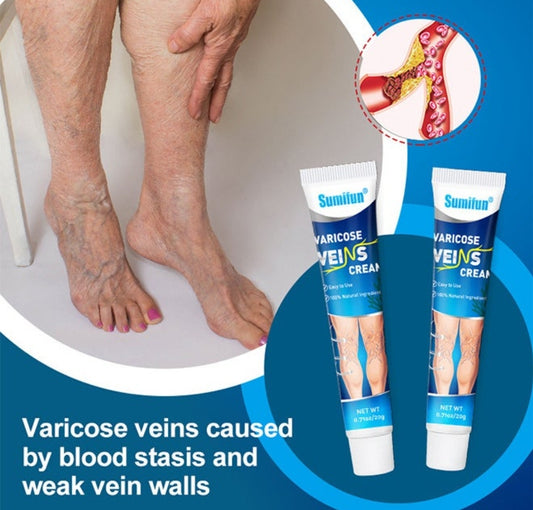Varicose Vein Cream For Legs, Improves Blood Circulation, Reduces Spider Veins And Heaviness, Improve Blood Circulation In The Legs - 20G كريم دوالي الساقين، يقلل من الأوردة العنكبوتية والثقل، ويحسن الدورة الدموية في الساقين